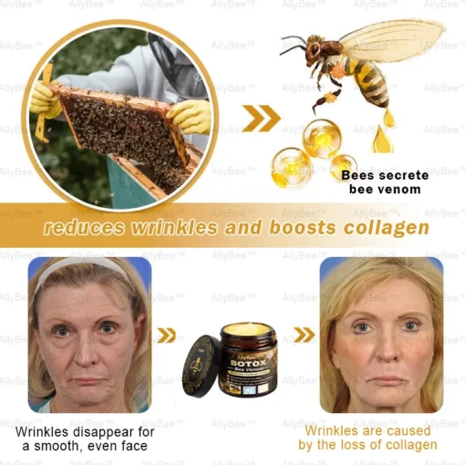 AllyBee™ Botox Bee Venom Wrinkle Removal Cream