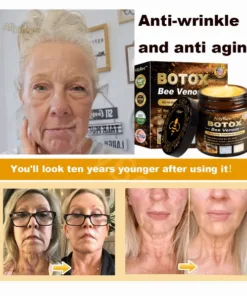 AllyBee™ Botox Bee Venom Wrinkle Removal Cream