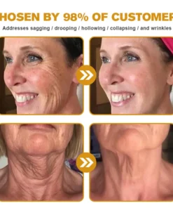 𝗧𝗟𝗢𝗣𝗔® Botox Bee Venom Wrinkle Removal Cream