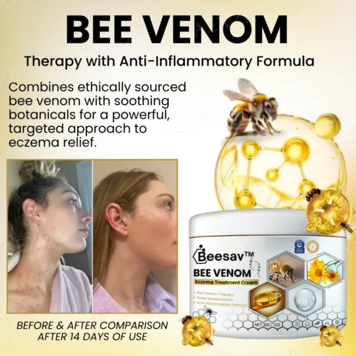 Beesav™ Bee Venom Eczema Treatment Cream